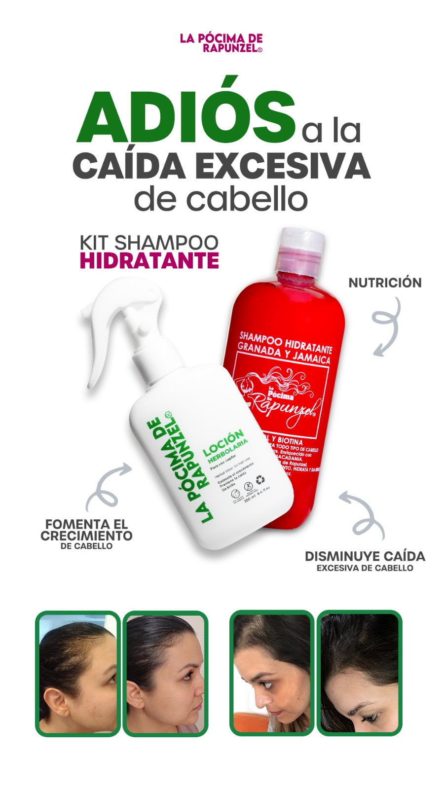 KIT SHAMPOO HIDRATANTE anti-caída p/cabello seco y loción herbolaria p/crecimiento