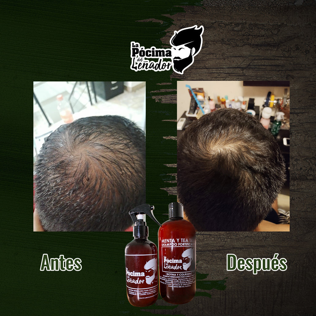 Tratamiento Intensivo Anti-grasa, cabello, barba y bigote